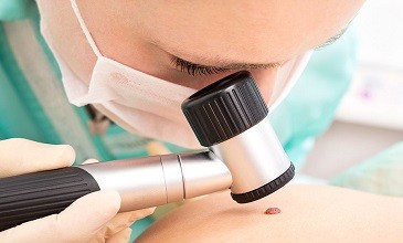 Дерматоскопия